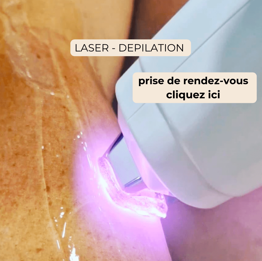🌿 1. Épilation Classique – Pour une peau nette au naturel, en douceur L’épilation classique (à la cire, à la pince ou au fil) reste une méthode incontournable pour entretenir une peau douce, dessiner une ligne de sourcils ou entretenir certaines zones délicates. Elle permet une repousse plus lente et plus fine qu’un simple rasage.  ✨ Pourquoi on l’aime : Épilation nette et précise  Duvet et poils éliminés dès la racine  Résultat immédiat, sans temps d’arrêt  Adaptée à toutes les zones (sourcils, lèvres, jambes, etc.)  📌 Quelques conseils : La peau doit être propre, non irritée  Exfoliation douce 48h avant pour prévenir les poils incarnés  Idéal entre deux cures d’épilation définitive  💡 L’épilation traditionnelle : la méthode simple et efficace qui a fait ses preuves.