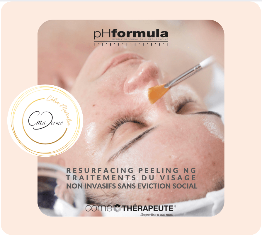 les traitements peeling nouvelles génération pH Formula